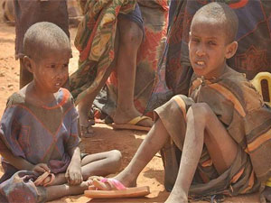 Malnutrition Malnutrition