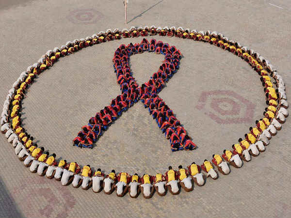 hiv aids hiv aids