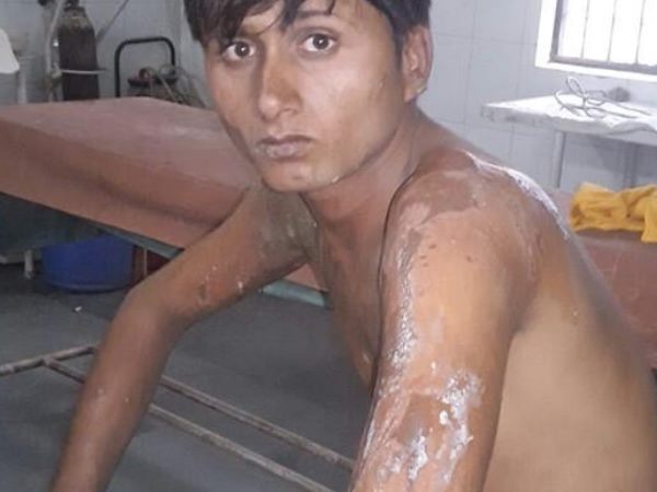 acid attack acid attack