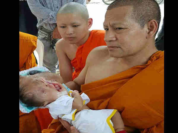 OMG! baby girl born blind and without a skull OMG! baby girl born blind and without a skull