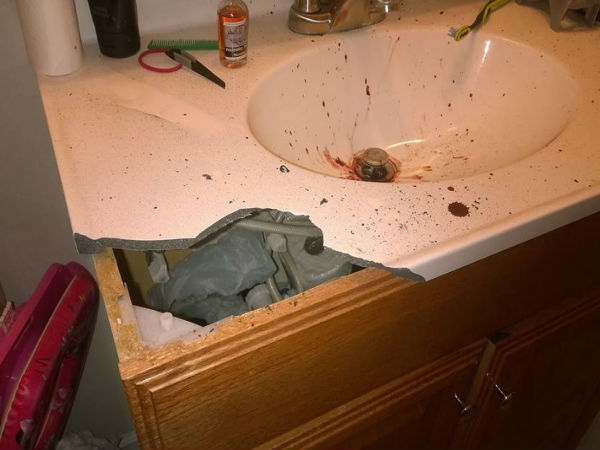 Man loses seven teeth after e-cigarette explosion Man loses seven teeth after e-cigarette explosion