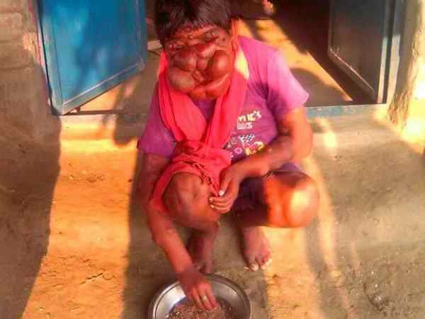 इस रोग के चलते बीच में ही छूटी मिथुन की पढ़ाई