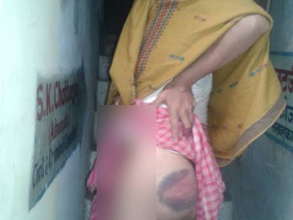 यूपी पुलिस का कारनामा, मामूली जुर्म कबूल करवाने के लिए दी थर्ड डिग्री यूपी पुलिस का कारनामा, मामूली जुर्म कबूल करवाने के लिए दी थर्ड डिग्री