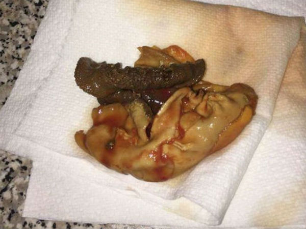 Beware: Women found foetus like structure in tomato juice Beware: Women found foetus like structure in tomato juice