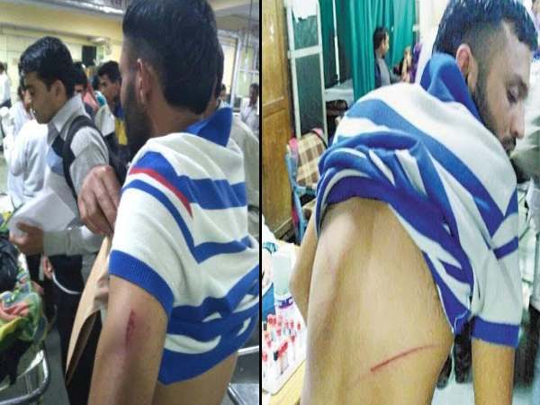 छात्रों के दो गुटों में मारपीट, HPU का माहौल तनावपूर्ण छात्रों के दो गुटों में मारपीट, HPU का माहौल तनावपूर्ण