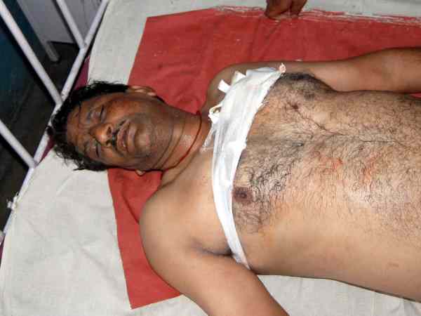 बेटी को लगी पहली गोली