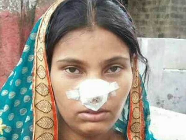 रंजीत ने काट ली खजाना की नाक