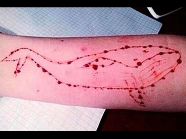 West Bengal: Blue Whale Challenge claims another life West Bengal: Blue Whale Challenge claims another life