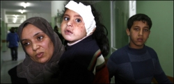 gaza wound gaza wound