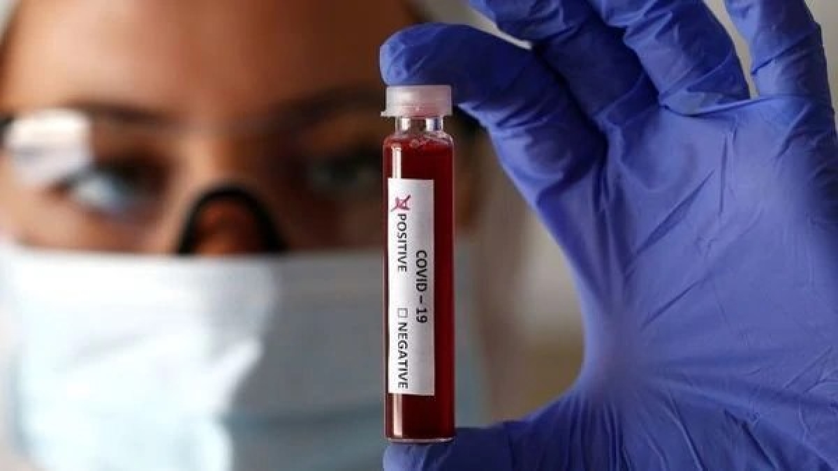 coronavirus update: India reports 4,777 fresh cases in the last 24 hours coronavirus update: India reports 4,777 fresh cases in the last 24 hours