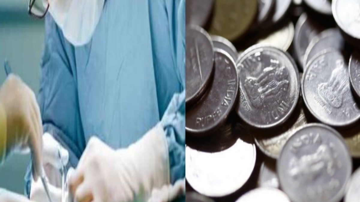 58 साल का शख्स के पेट में मिले है ये सिक्के