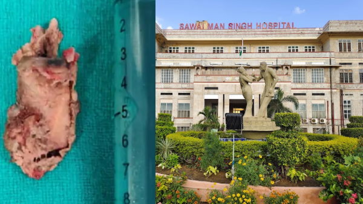 SMS Hospital SMS Hospital