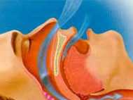 खरार्टों से आप पा सकते हैं निजात