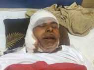 'कलयुगी' बेटे की करतूत: पहले काटी पिता की गर्दन, फिर फेवीक्विक से लगा चिपकाने