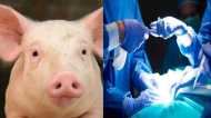 Organ Transplant: मनुष्य में धड़का फिर सूअर का दिल, भविष्य में अंग प्रत्यारोपण के लिए बनेगा विकल्प?