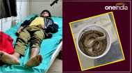 UP News: युवक को कोबरा ने काटा, डिब्बे में भरकर पहुंचा अस्पताल, बोला- डॉक्टर साहब, जल्दी करिए...