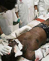 Sri Lanka Blast Sri Lanka Blast