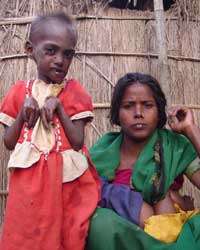 Japanese Encephalitis Japanese Encephalitis