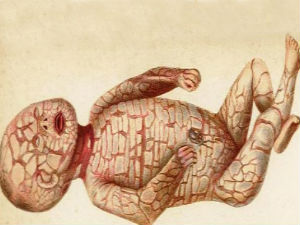baby body baby body