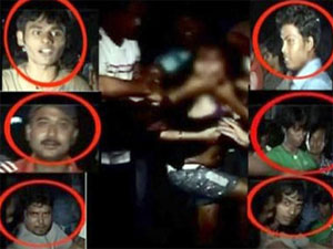 NWC team finds cigarette burns on molested girl's body NWC team finds cigarette burns on molested girl's body