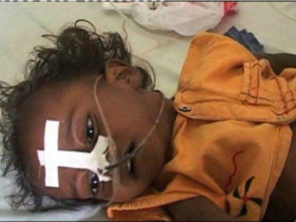 अलग-अलग जिलों के बच्चों की मौत