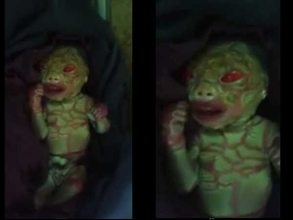 A strange child borns in Chhattisgarh A strange child borns in Chhattisgarh