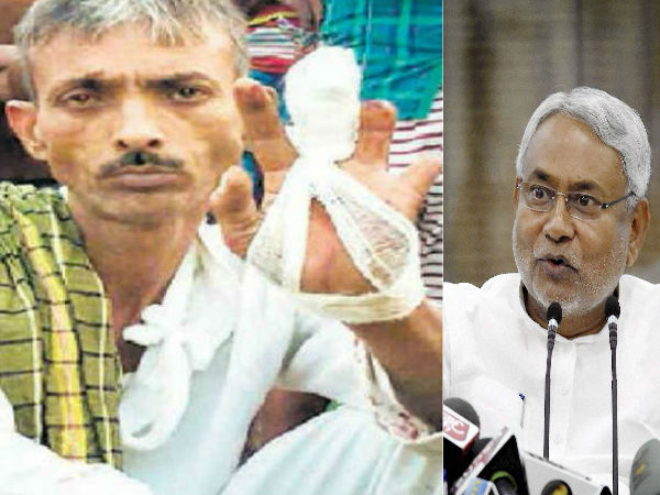 Man chops finger over Nitish Kumar’s win Man chops finger over Nitish Kumar’s win