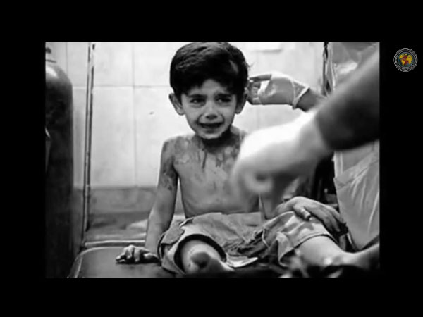 मानसिक तनाव का शिकार बच्चे