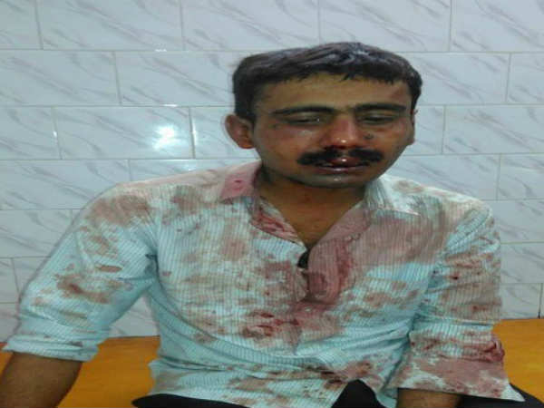Attack on Telegraph newspaper employee in Patna Attack on Telegraph newspaper employee in Patna