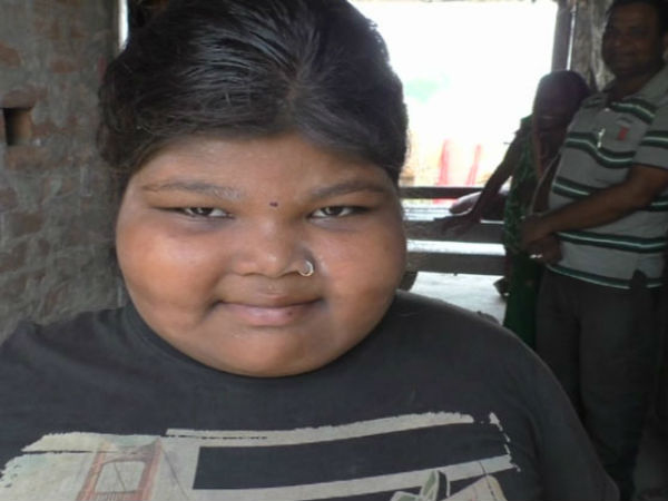 OMG! लड़की की उम्र 8 साल और वजन 85 किलो