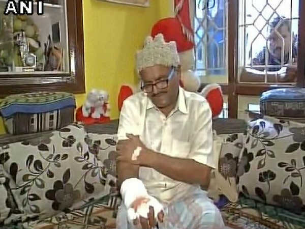 ईमानदारी की मिली सज़ा, ठेकेदारों ने कुल्हाड़ी से काट दिया अधिकारी का हाथ ईमानदारी की मिली सज़ा, ठेकेदारों ने कुल्हाड़ी से काट दिया अधिकारी का हाथ
