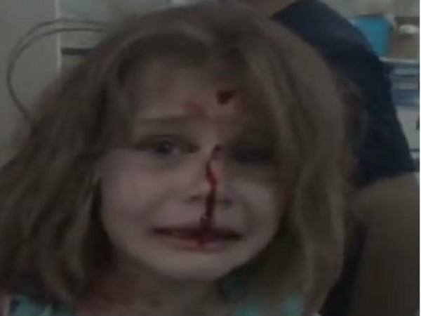 pm modi shared tale of this syrian child girl during dussehra speech. नई दिल्ली। दशहरे के अवसर पर प्रधानमंत्री नरेंद्र मोदी ने लखनऊ के ऐशबाग में अपने भाषण के दौरान जिस सीरियाई बच्ची का जिक्र किया था, उसका वीडियो सामने आया है। pm modi shared tale of this syrian child girl during dussehra speech. नई दिल्ली। दशहरे के अवसर पर प्रधानमंत्री नरेंद्र मोदी ने लखनऊ के ऐशबाग में अपने भाषण के दौरान जिस सीरियाई बच्ची का जिक्र किया था, उसका वीडियो सामने आया है।