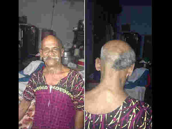 Food Vendor Sets Fire To ₹23,000 Savings In Old Notes Food Vendor Sets Fire To ₹23,000 Savings In Old Notes