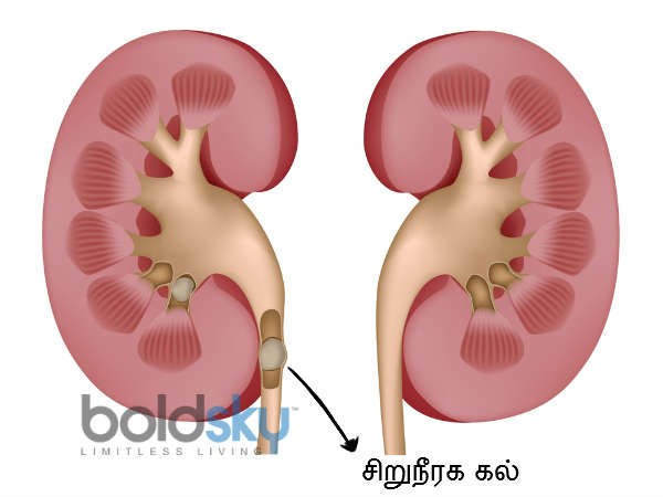 बहन की शादी के लिए उसे रुपयों की जरूरत