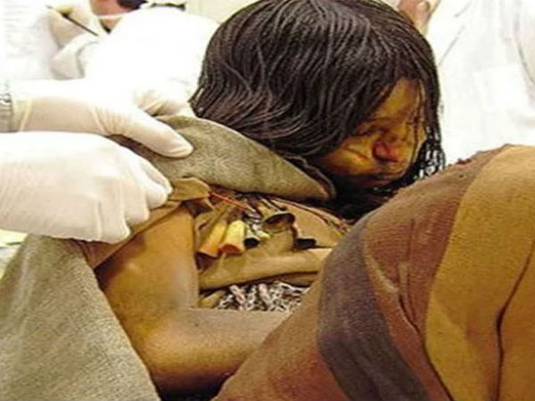 खून में मिले टीबी के बैक्टिरिया