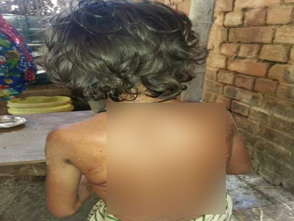 मां ने ढाए जुल्मों-सितम, बेटियों को जला-जलाकर पिलाया नाली का पानी मां ने ढाए जुल्मों-सितम, बेटियों को जला-जलाकर पिलाया नाली का पानी