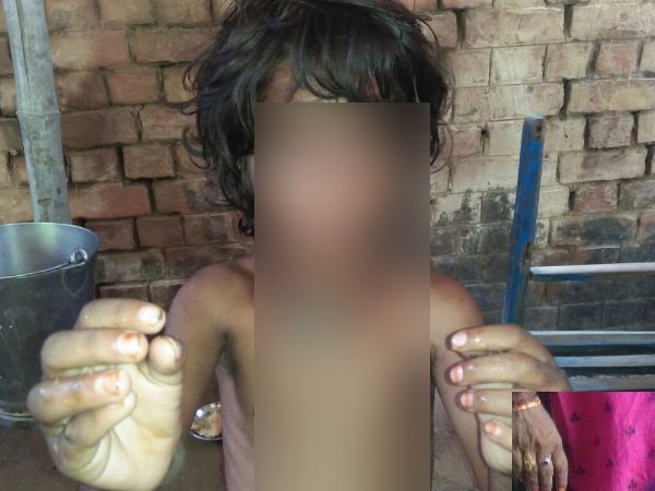 मां ने ढाए जुल्मों-सितम, बेटियों को जला-जलाकर पिलाया नाली का पानी मां ने ढाए जुल्मों-सितम, बेटियों को जला-जलाकर पिलाया नाली का पानी