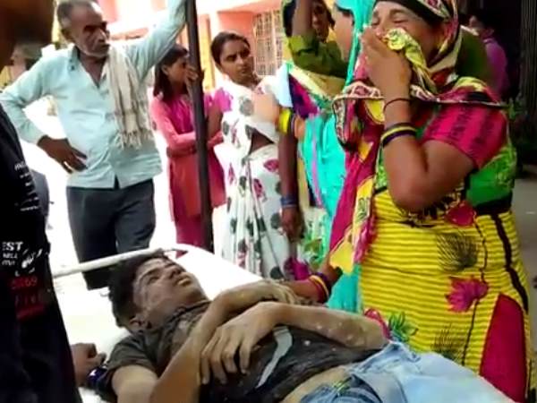 गंभीर रूप से घायल लखनऊ रेफर