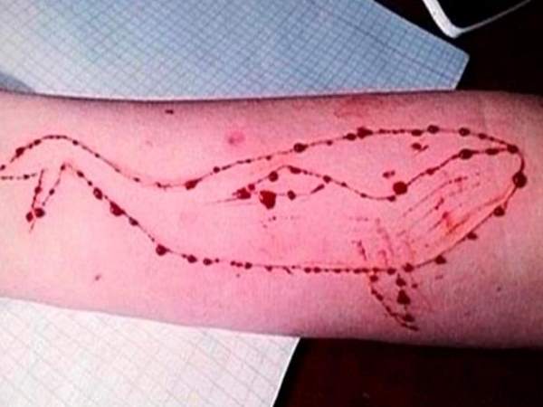 सोलन में बच्चों ने ब्लेड से हाथ काटकर बनाया था ब्लू ह्वेल