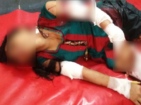 One sided lover attacked on girl in lakhimpur One sided lover attacked on girl in lakhimpur