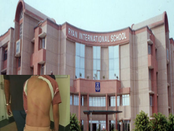 Ryan International School: Class 4 student allegedly beaten by 2 teacher complain lodged Ryan International School: Class 4 student allegedly beaten by 2 teacher complain lodged