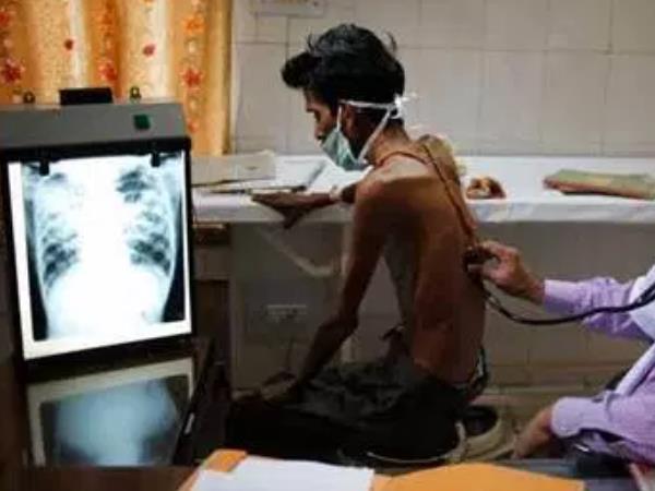 India Topped Global Tuberculosis Fatalities WHO Report 4.23 Lakh Deaths in 2016 India Topped Global Tuberculosis Fatalities WHO Report 4.23 Lakh Deaths in 2016