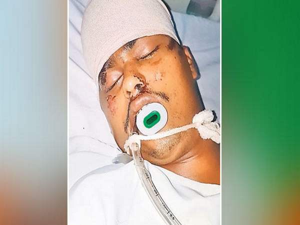 मरने के बाद भी 4 लोगों की जिंदगी में रोशनी दे गया यह युवक मरने के बाद भी 4 लोगों की जिंदगी में रोशनी दे गया यह युवक