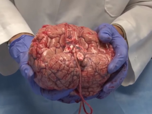 Human Brain Human Brain