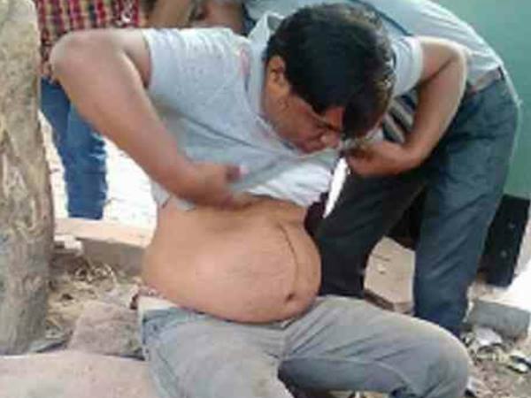पुलिस ने अस्पताल में भर्ती कराया