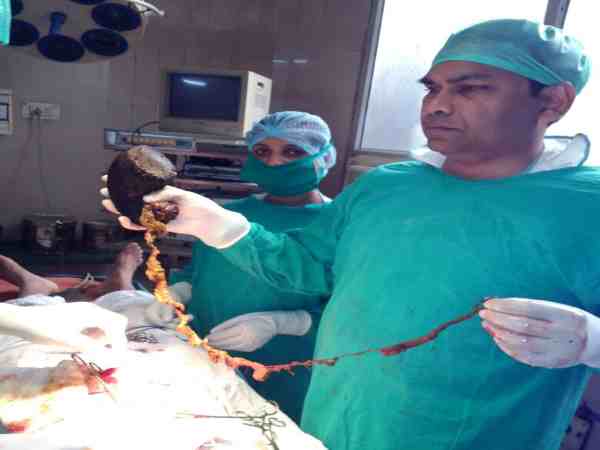 अल्ट्रासाउंड में दिखा पेट में गोला