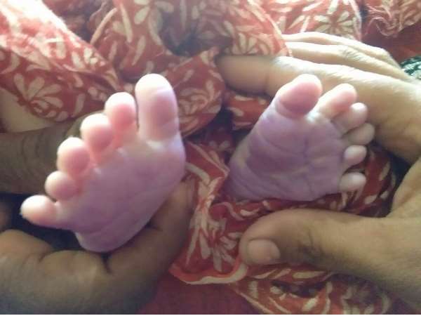 A strange child born in Maharashtra A strange child born in Maharashtra