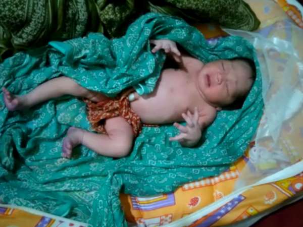 A strange child born in Maharashtra A strange child born in Maharashtra