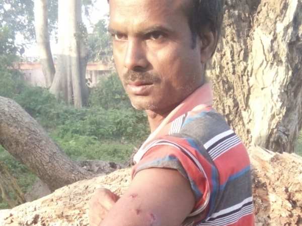 Santosh fight with leopard in Bahraich, Uttar Pradesh Santosh fight with leopard in Bahraich, Uttar Pradesh