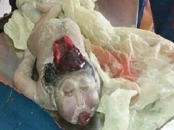An strange child born in Buxor, Bihar An strange child born in Buxor, Bihar